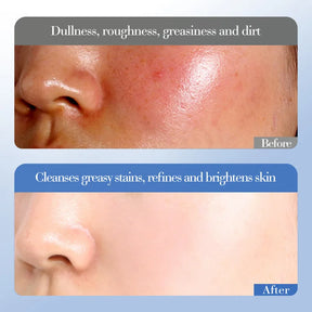 Conjunto de Cuidados Essenciais com a pele , soro facial clareador, creme removedor de rugas, encolhe os poros, desbota, melanina opaca, hidrata e ilumina, (6 peças)